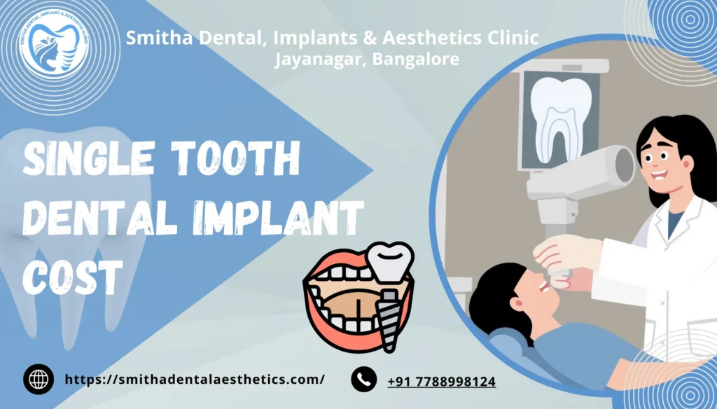 Single Tooth Dental Implant Cost